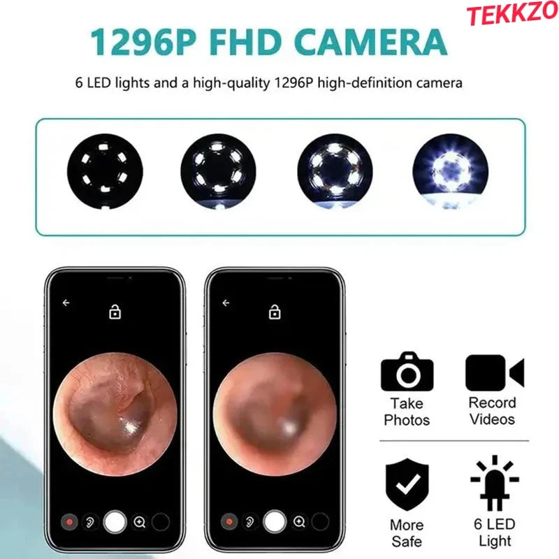 1296P FHD ear camera with 6 LED lights showcasing detailed ear canal images on smartphone screens