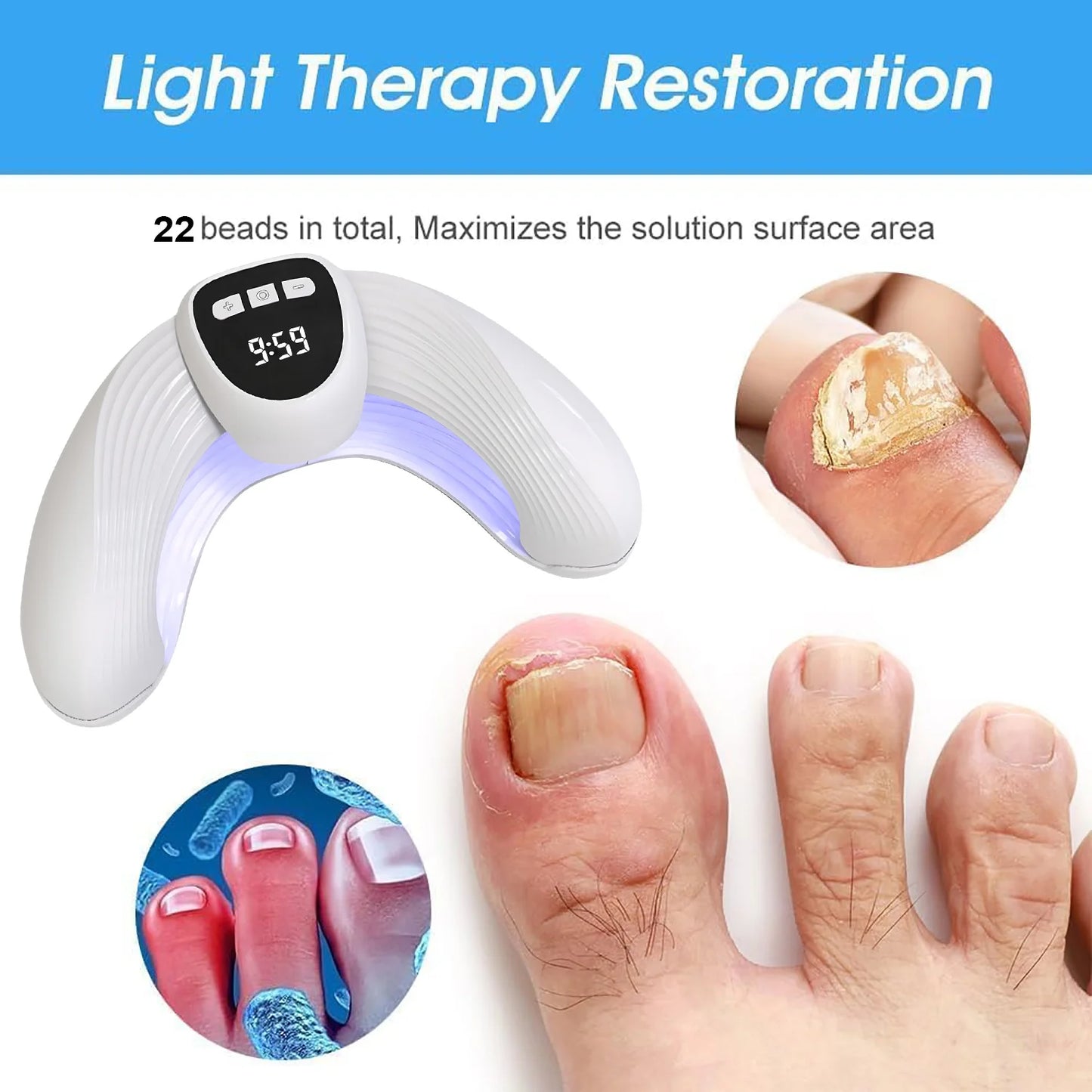 Nail Fungal Laser Treatment Device Repair Anti Infection Paronychia Onychomycosis Ingrown Toenail Foot Care