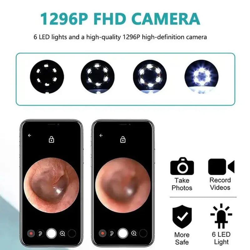 Wireless Smart Visual Ear Cleaner Otoscope Ear Wax Removal Tool With 1296P Camera Ear Endoscope Ear Tools Health Care Kit